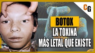 Toxina Botulínica  Botox LA TOXINA mas PODEROSA del Mundo  Fisiopatología y Síntomas del Botulismo [upl. by Yngiram]