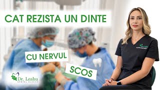 Cat rezista un dinte cu nervul scos  Clinicile Dentare Dr Leahu [upl. by Caswell]