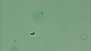 【寄生虫】Giardia intestinalis trophozoite （ランブル鞭毛虫栄養型） [upl. by Ruenhcs]