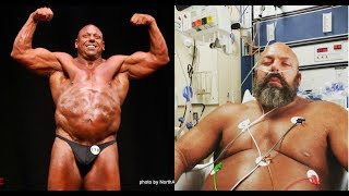 Big Lenny Hospitalized Again [upl. by Ecenaj]