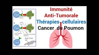 Cancer du Poumon Réponse de lImmunité AntiTumorale Thérapie cellulaire [upl. by Koeninger]