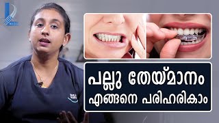 പല്ലു തേയ്മാനം എങ്ങനെ പരിഹരിക്കാം  How to solve Teeth Grinding  L Bug Media [upl. by Astrix]