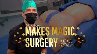 Witness these Magical Lipo and BBL Results Vive Plastic Surgery Dr Anaya [upl. by Madancy473]