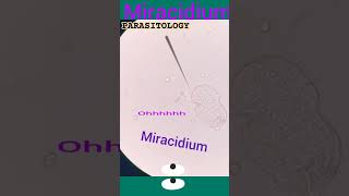 Miracidium of schistosoma mansoniSchistosomiasisParasitic worm disease👍Parasitology👍🔬✅ [upl. by Innavoij]