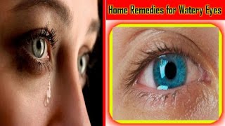 Home Remedies for Watery Eyes Dur Kare Aankhon ka Pani [upl. by Dove669]