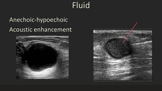 Ultrasound 101 Part 5 Terminology and Tissuesmp4 [upl. by Darcey]