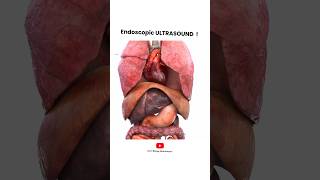 Endoscopic Ultrasound procedure  Short Animated Video [upl. by Ayouqes323]