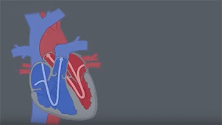 Congenital Heart Defects CHDs [upl. by Salvador542]