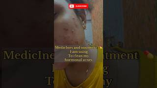 🎥hormonal acne journey 😓viral shorts trending hormonalacne acnetreatment acneremoval [upl. by Cymbre854]