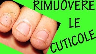 COME RIMUOVERE LE CUTICOLE Sos unghie 9 [upl. by Finlay]