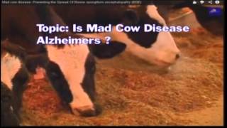 Is Alzheimers Mad Cow Disease part one [upl. by Kho]