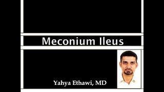 Meconium Ileus [upl. by Idonna789]