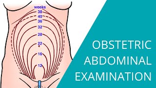 Obstetric Abdominal Examination  Steps for examining a pregnant woman [upl. by Blockus]