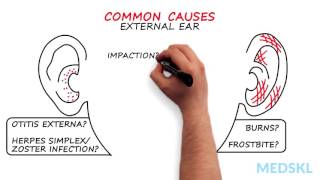 Ear Nose and Throat – Otalgia Ear Pain By Russell Hollins MD [upl. by Yreffoeg]