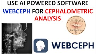 How to use Webceph for cephalometric analysis  FREE AI Tool for Dentistry [upl. by Simon]