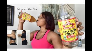 Drinking Apple Cider Vinegar  Lose weight FAST [upl. by Sinclare]