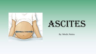 Ascites pathophysiology  liver cirrhosis CHF nephrotic syndrome exudativechylousnephrogenic [upl. by Nwahsed]