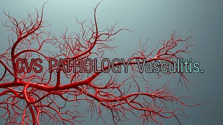 CVS pathology Vasculitis lecture [upl. by Tenenbaum]