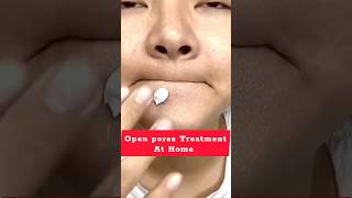 Viral open pores home remedy  blackheads removal  ওপেন পোরস দূর করার উপায় shorts viral diy [upl. by Lilllie13]