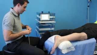 Shockwave Therapy Toronto Plantar Fasciitis Treatment [upl. by Anirahtak]