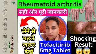 tofacitinib 5 mg tablet hindi  tofacitinib tablets 5mg  tofatas tablet 5 mg  tofakin tablet [upl. by Annaya]