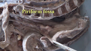 Anatomy labMedian Section of Head and Neckcadaver specimen by DrGosai [upl. by Nylaf]