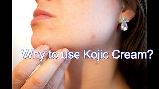 Kojic Cream 25 gm with Kojic acid and Vitamin C [upl. by Angeli]