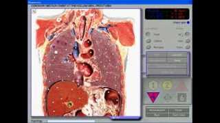 3D NLS Health Diagnosis and Treatment Computer System [upl. by Htiekal]