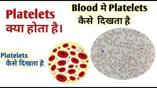 How to identify platelets I Platelet count in blood smear [upl. by Aenotna423]