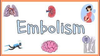 Embolism  Definition Types of Embolism amp Clinical Manifestations [upl. by Diego626]