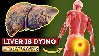 LIVER is DYING 12 Weird Signs of LIVER DAMAGE [upl. by Ariana]