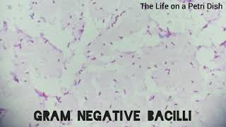 Gram positive cocci Gram negative bacilli and Yeast Cells Under the microscope [upl. by Ayra]