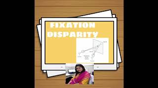 FIXATION DISPARITY  Lecture by Kriti Mitra [upl. by Breana]