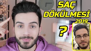 3 YILLIK DENEYİMİM SAÇ DÖKÜLMESİNİ DURDURAN ŞAMPUAN │ Aras Barlas [upl. by Eyanaj]