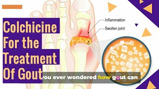 COLCHICINE Tablets For The GOUT Treatment [upl. by Lanahtan]