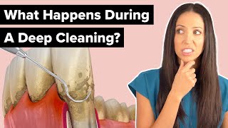 What Happens During a Deep Cleaning Procedure Scaling and Root Planing [upl. by Tim]