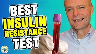 Insulin Resistance Test Best Test for IR amp Stubborn Weight Loss HomaIR [upl. by Berne]