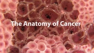 What Is Cancer What Causes Cancer amp How Is It Treated [upl. by Tterrej]