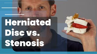 Herniated Disc VS Lumbar Stenosis [upl. by Peih]