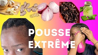 Comment faire pousser les cheveux PLUS RAPIDEMENT [upl. by Aineg]