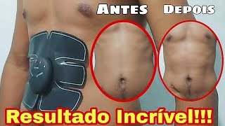 Estimulador Muscular  Resultado após 30 dias de uso [upl. by Aleemaj]