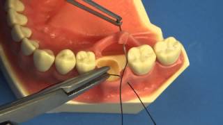 LEARN TO SUTURE THE EASY WAY  Surgical Technique  Interrupted Buccal Suturing  Dental  Medical [upl. by Zetta]