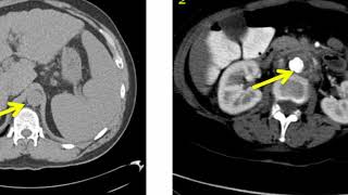 Introduction to Radiology Computed Tomography [upl. by Amalle]