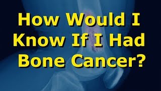 How Would I Know If I Had Bone Cancer [upl. by Umont]