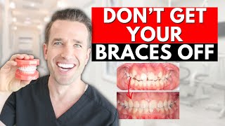 Braces Off How to know if youre DONE WITH BRACES [upl. by Tita615]