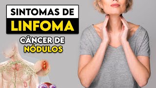 TOME CUIDADO Estes são os sinais e sintomas do LINFOMA │ Médico Explica [upl. by Analim]