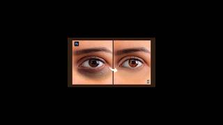 Remove Dark Circles and Brighten Eyes in Photoshop youtubeshorts shorts shortvideo foryou [upl. by Eiser]