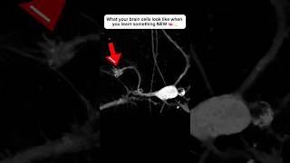 Brain cell restructures itself after forming a new connection neuroplasticity neuroscience brain [upl. by Adriel524]