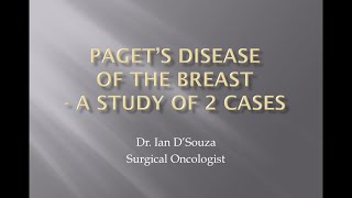 Pagets disease [upl. by Rasure611]