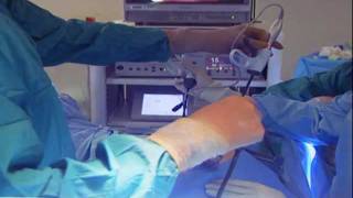 Laparoscopic Hysterectomy [upl. by Harle721]